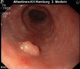 Duodenum